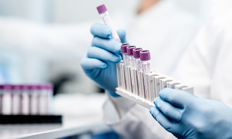 test tubes in a laboratory